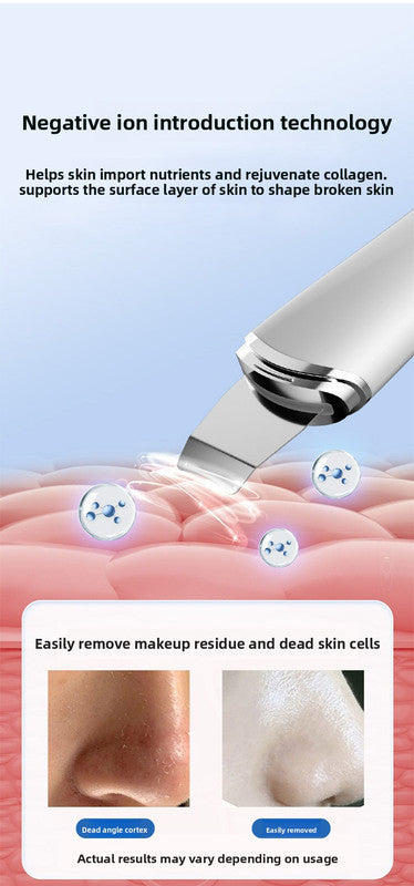 Ultrasonic Skin Scrubber Facial Spatula Blackhead Remover & Pore Cleaner with Ion EMS